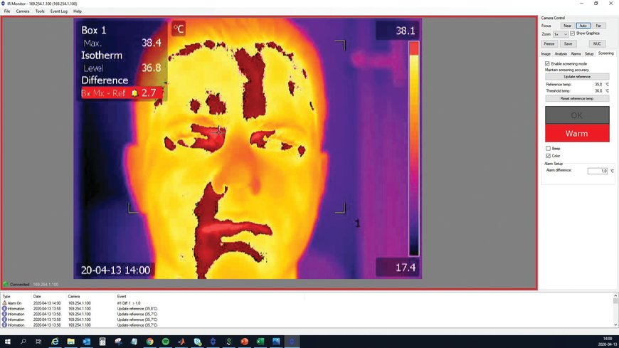 Thermal imaging to screen for elevated skin temperature
